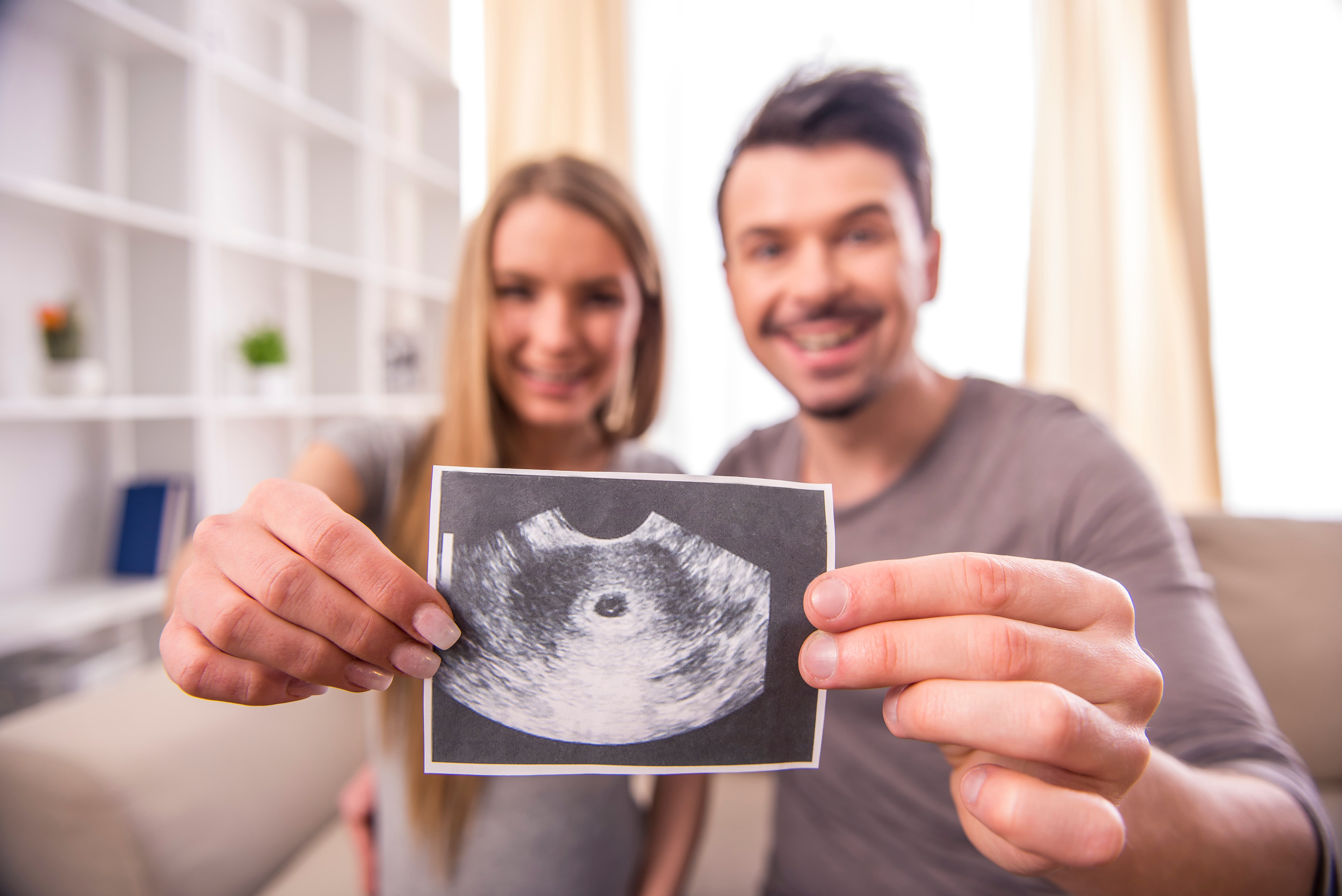 Happy couple are holding ultrasound scan of their baby.